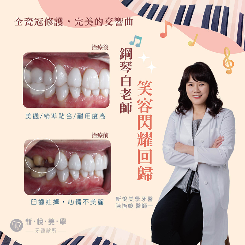 新悅美學牙醫診所的案例分享圖片